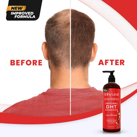 shiny leaf scalp massage in shower showing improved scalp circulation