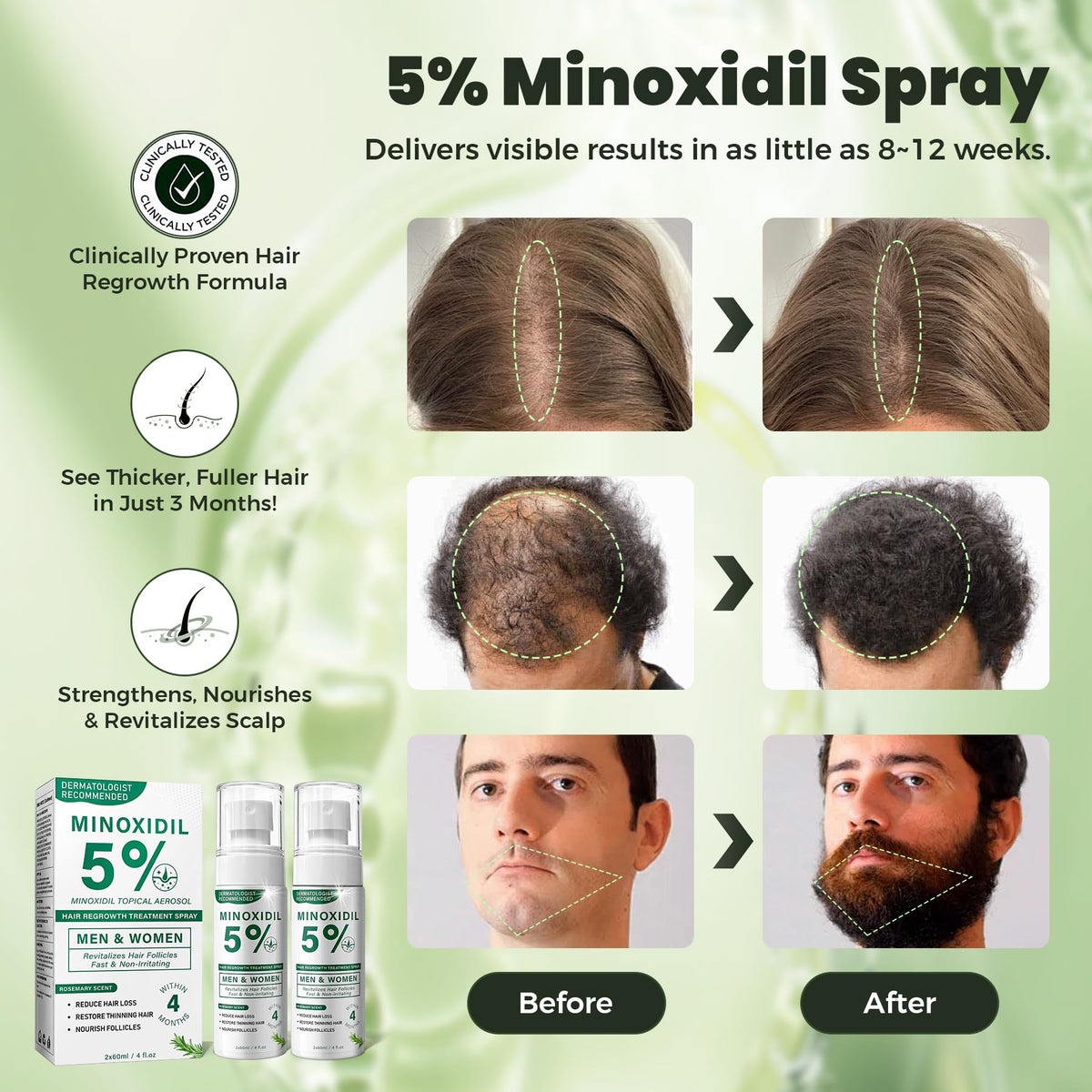 SHIUMORE mist on scalp texture illustrating fast-absorbing non-greasy formula