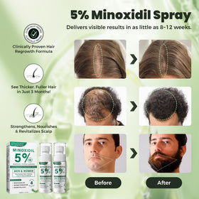 SHIUMORE mist on scalp texture illustrating fast-absorbing non-greasy formula