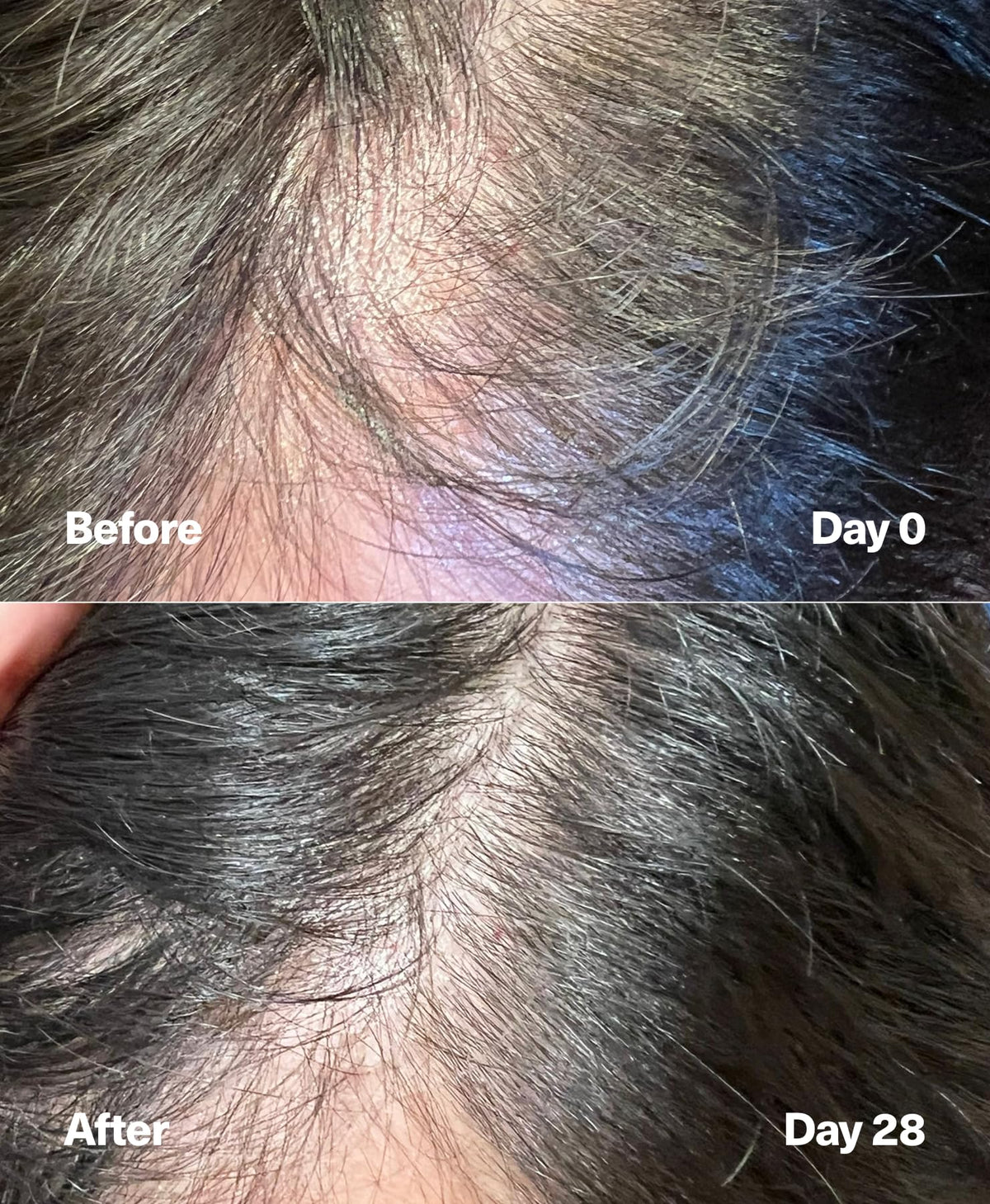 SickScience crown area before and after lift demonstration, visible volume benefit