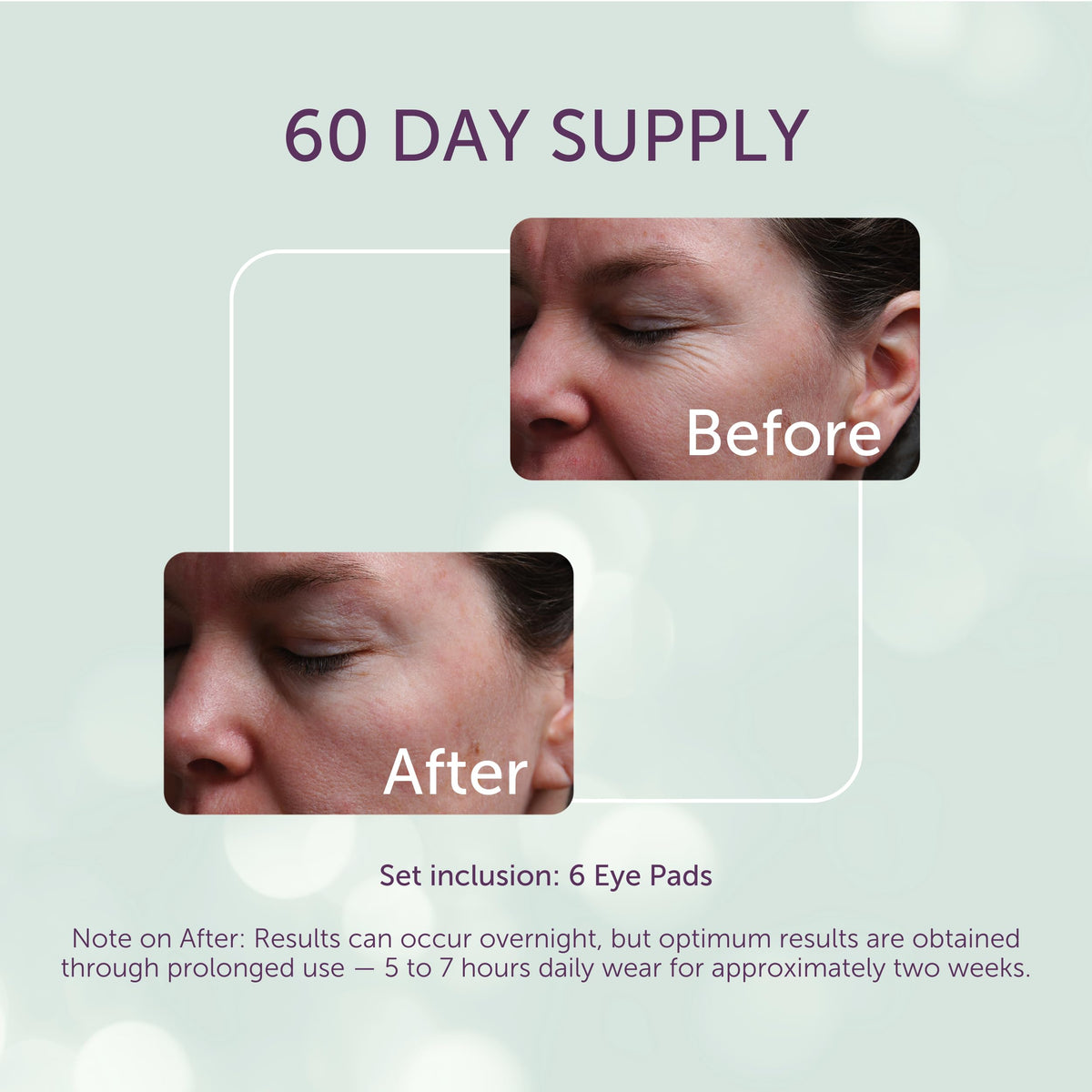 Silc Skin pad applied under eye demonstrating comfortable fit