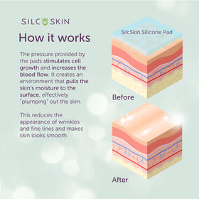 Silc Skin pads on storage liner illustrating clean storage benefit