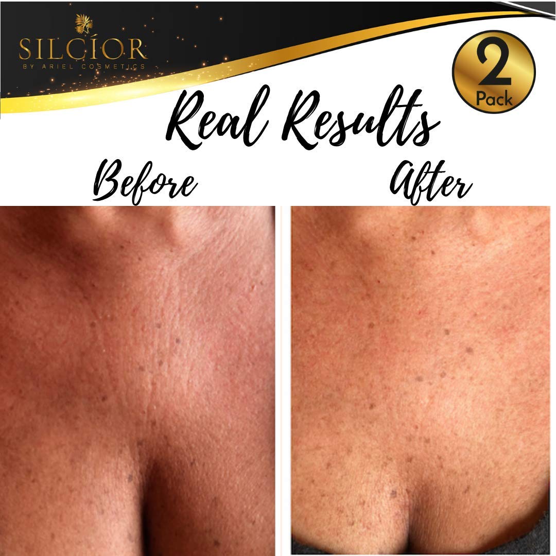 SILCÍOR pad worn on chest demonstrating overnight comfort