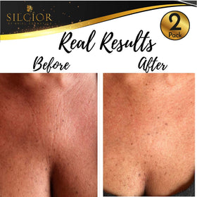 SILCÍOR pad worn on chest demonstrating overnight comfort