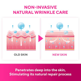 SILKDERMIS smile line patch on face showing smoothing effect