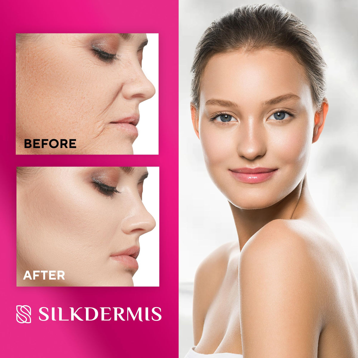 SILKDERMIS smile line patch shape displayed to show coverage and flexibility