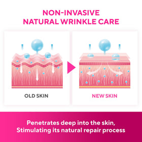 SILKDERMIS under-eye patch detail highlighting thin contour and gentle support