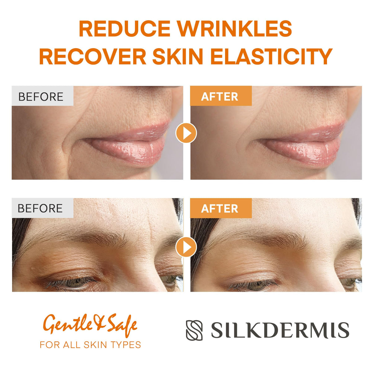 SILKDERMIS under-eye patch in use illustrating gentle crease reduction