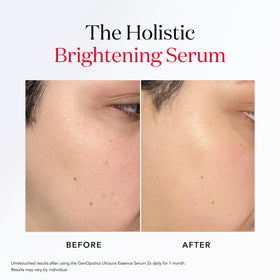SK-II applying serum to cheek illustrating targeted spot treatment benefit