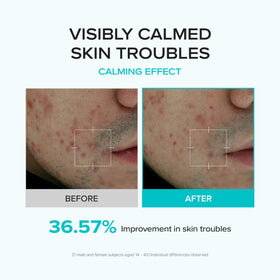 SKIN & LAB label close-up listing azelaic acid, bifida ferment, arbutin benefits