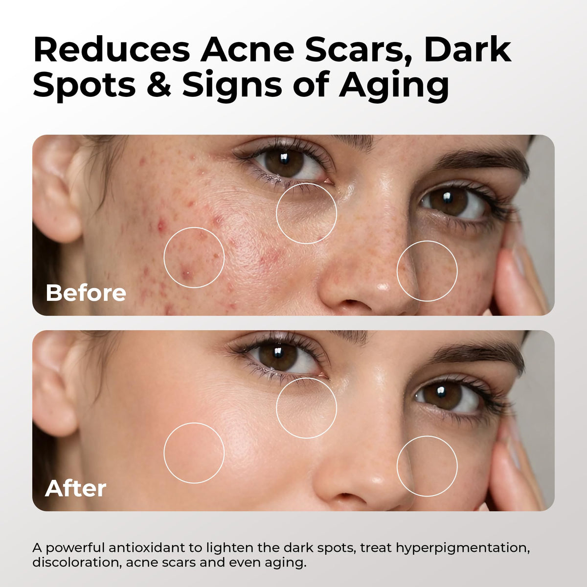 SKIN DEVA being applied to cheek illustrating layering under moisturizer and glow