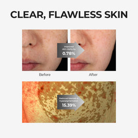 SKIN & LAB next to sunscreen illustrating daytime layering and protection routine