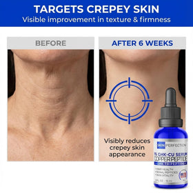 Skin Perfection serum texture on fingertip showing lightweight hydrating feel