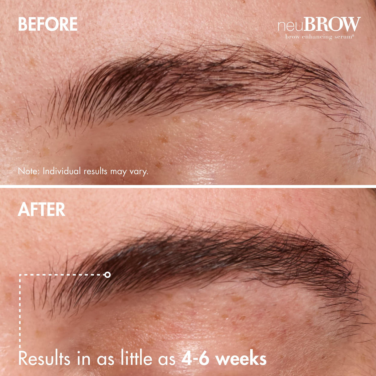 Skin Research Laboratories neuBROW before and after brows showing fuller appearance
