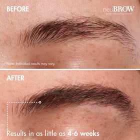 Skin Research Laboratories neuBROW before and after brows showing fuller appearance