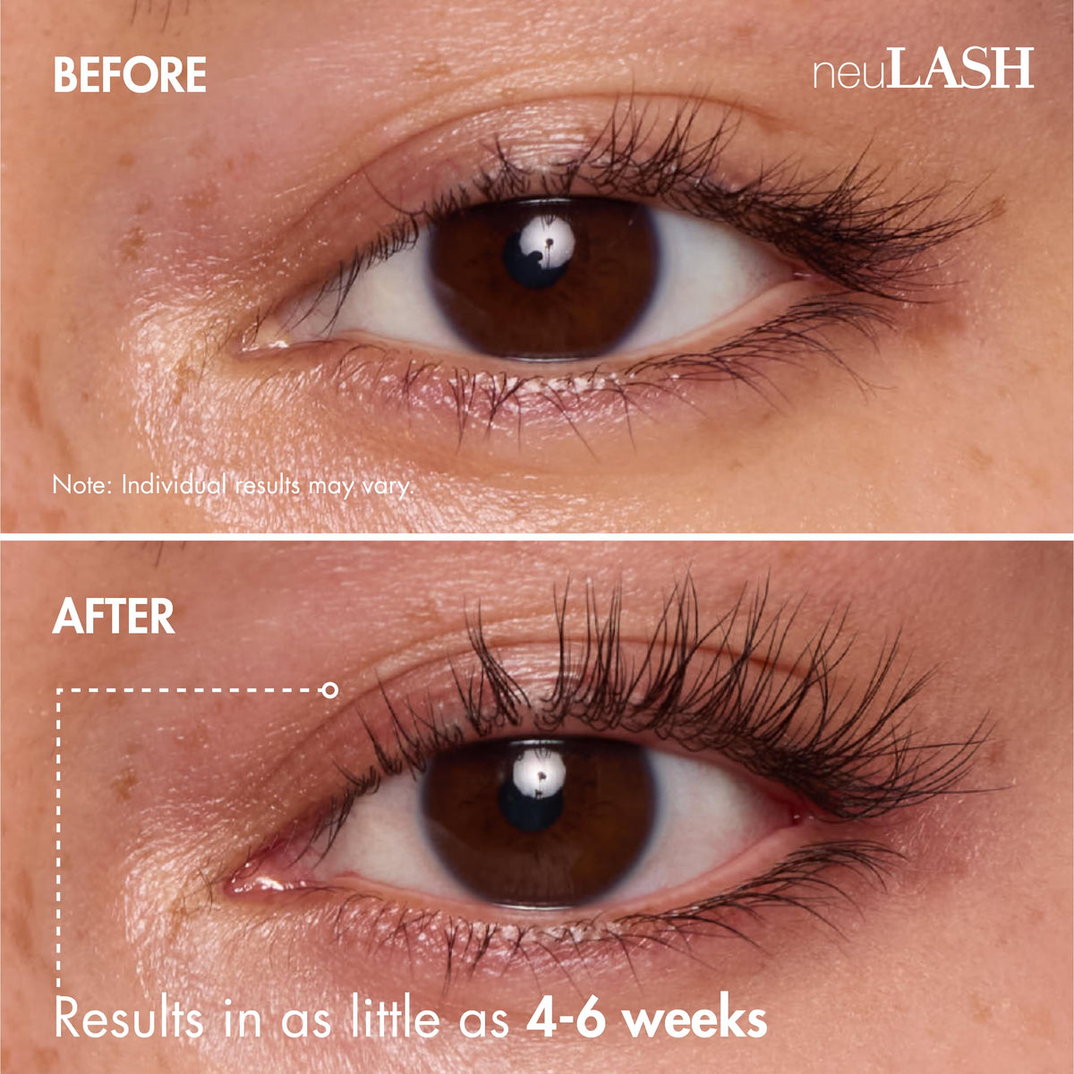 Skin Research Laboratories neuLASH bottle next to ruler showing 3.2 mL scale