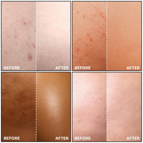 SKINBOSS being applied to thigh demonstrating targeted, non-greasy treatment