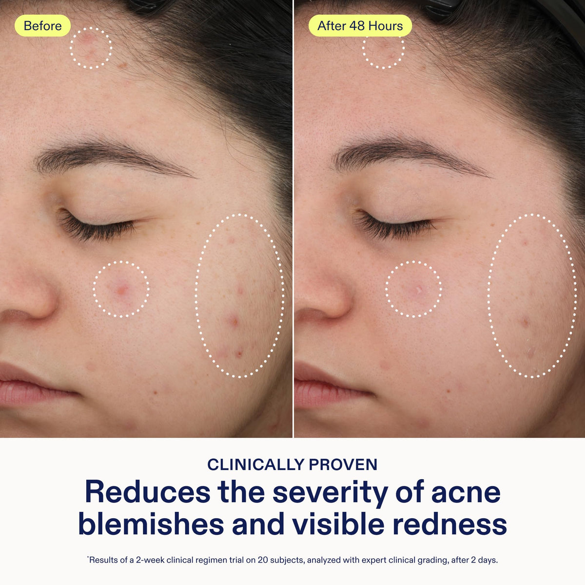 Skinfix lightweight serum texture close-up showing easy absorption benefit