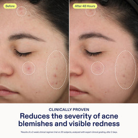 Skinfix lightweight serum texture close-up showing easy absorption benefit