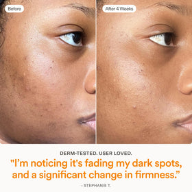 Skinfix bottle beside SPF and moisturizer showing daytime routine benefit