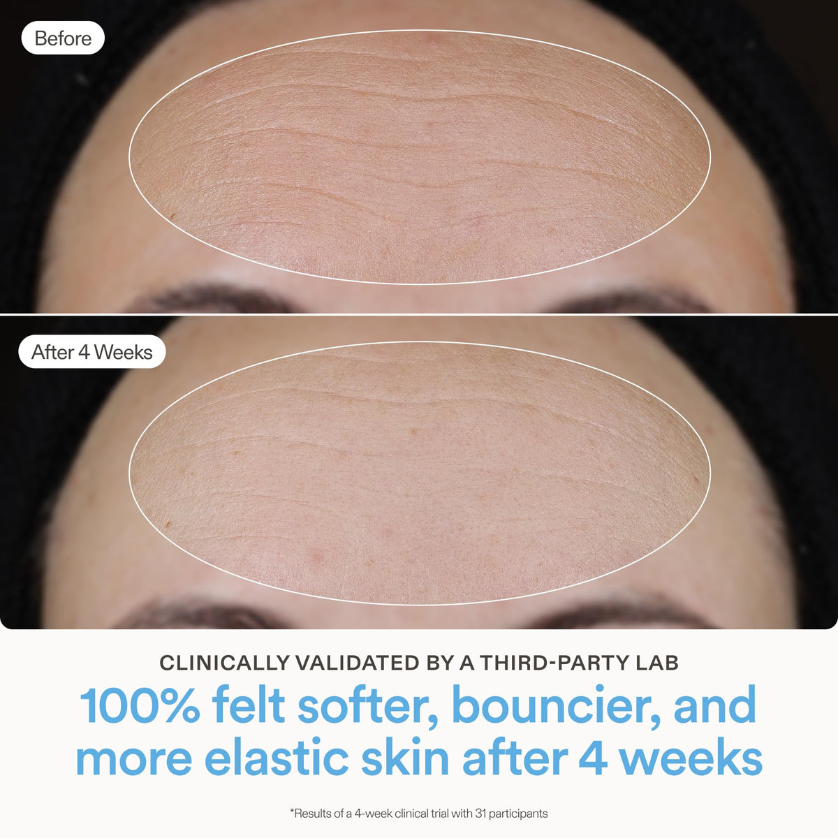 Skinfix ingredients label close-up highlighting ceramides, niacinamide and peptides for barrier support
