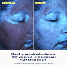 Skinfix lathered foam in hand demonstrating gentle cleansing action