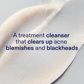 Skinfix pump and bottle label close-up highlighting active ingredients and dosage
