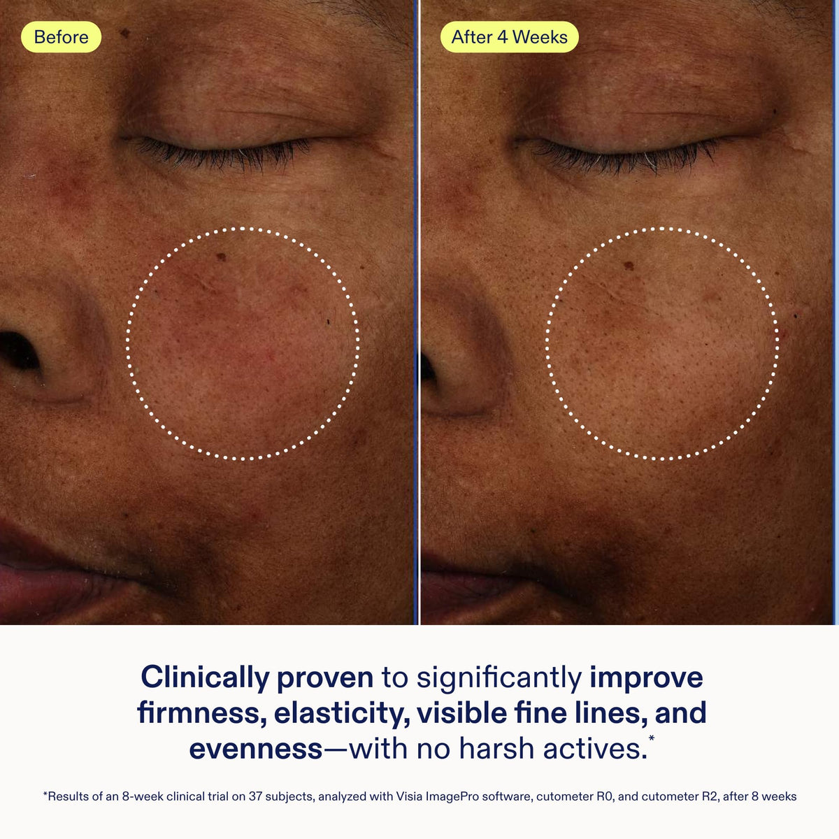 Skinfix baume held in hand to show 1 oz scale and portability benefit