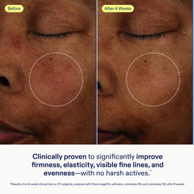 Skinfix baume held in hand to show 1 oz scale and portability benefit