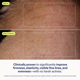 Skinfix product label with ingredient callouts for transparency benefit