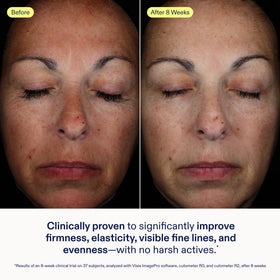 Skinfix baume creamy texture close-up for deep hydration benefit