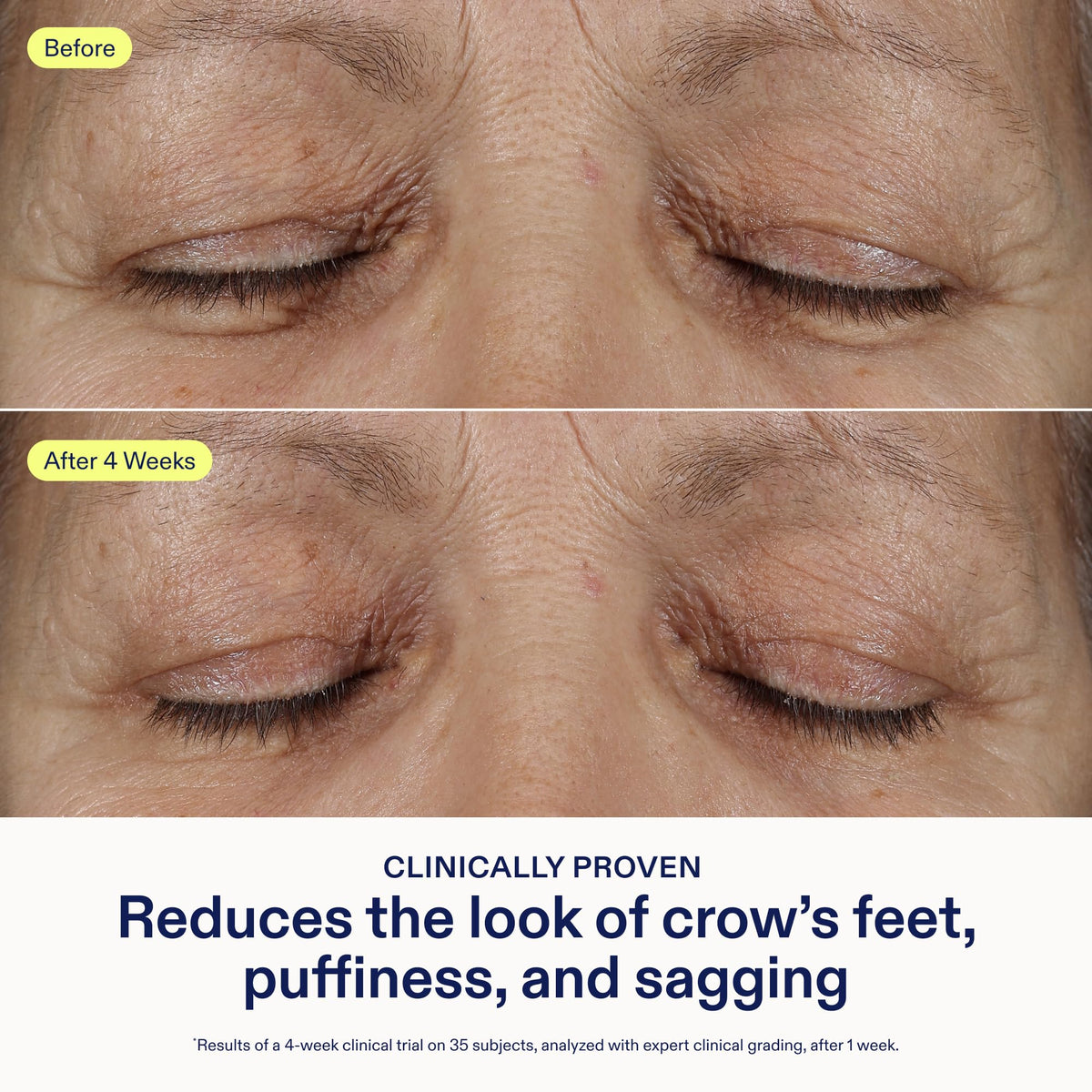 Skinfix product with highlighted ingredients, illustrating active benefits