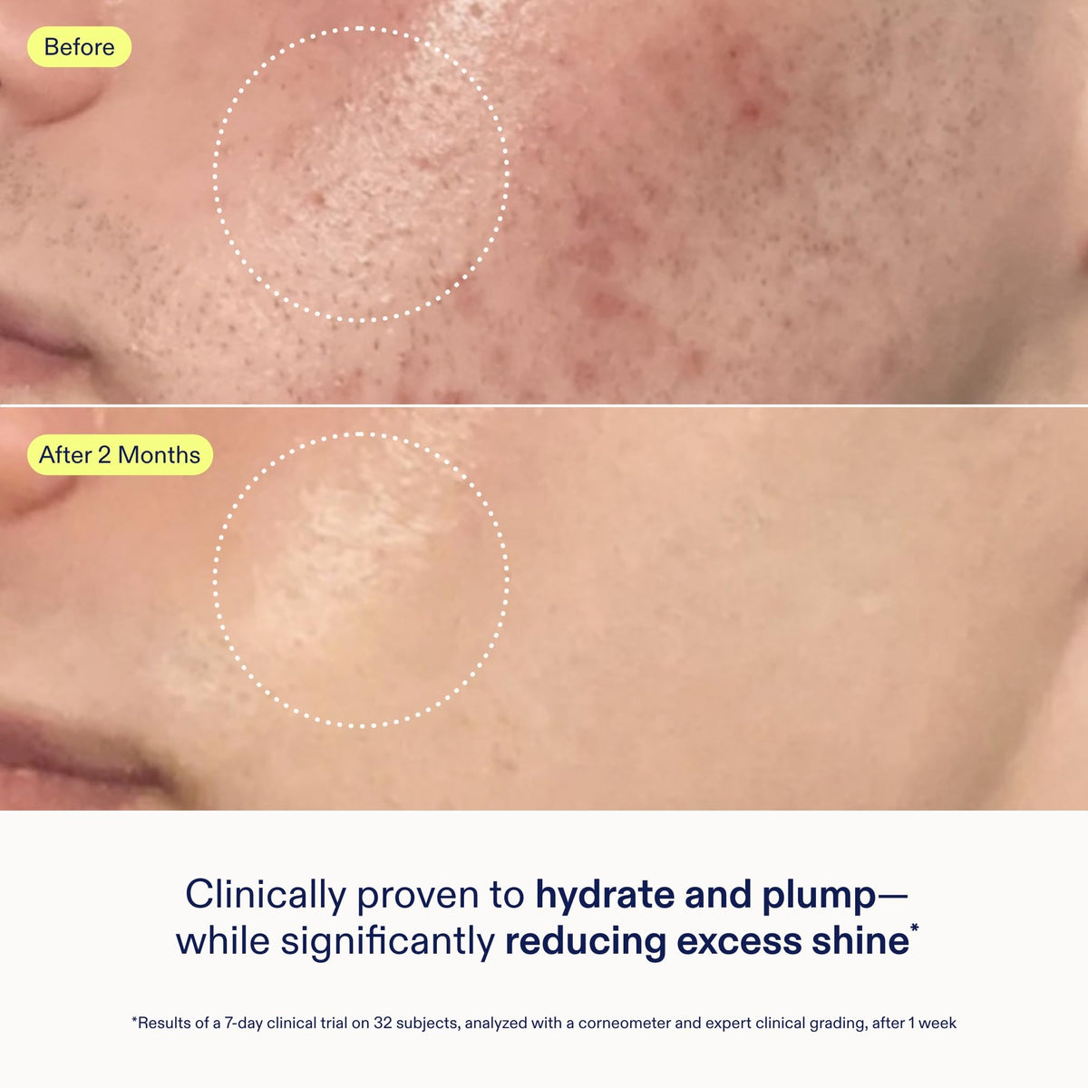 Skinfix ingredient display with hyaluronic visuals highlighting lasting hydration benefit