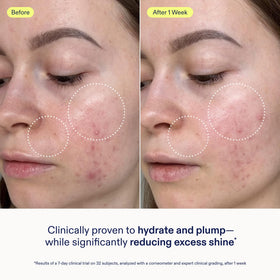 Skinfix close-up of dispensing gel cream demonstrating easy pump use and controlled amount