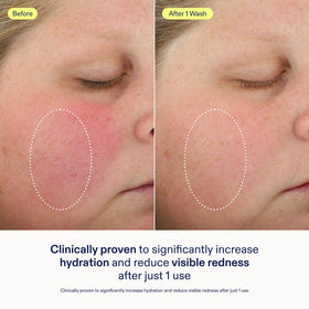 Skinfix lather in hand showing gentle gel-to-foam transformation