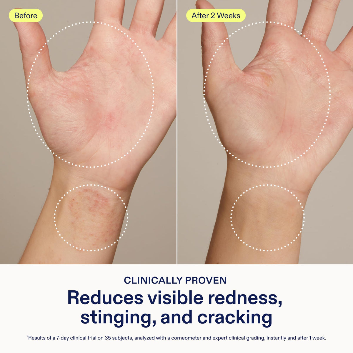 Skinfix ingredient label detail highlighting colloidal oatmeal and ceramides benefits