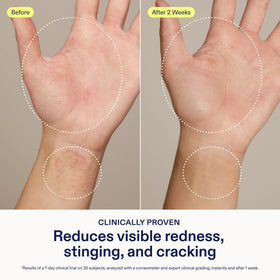 Skinfix ingredient label detail highlighting colloidal oatmeal and ceramides benefits