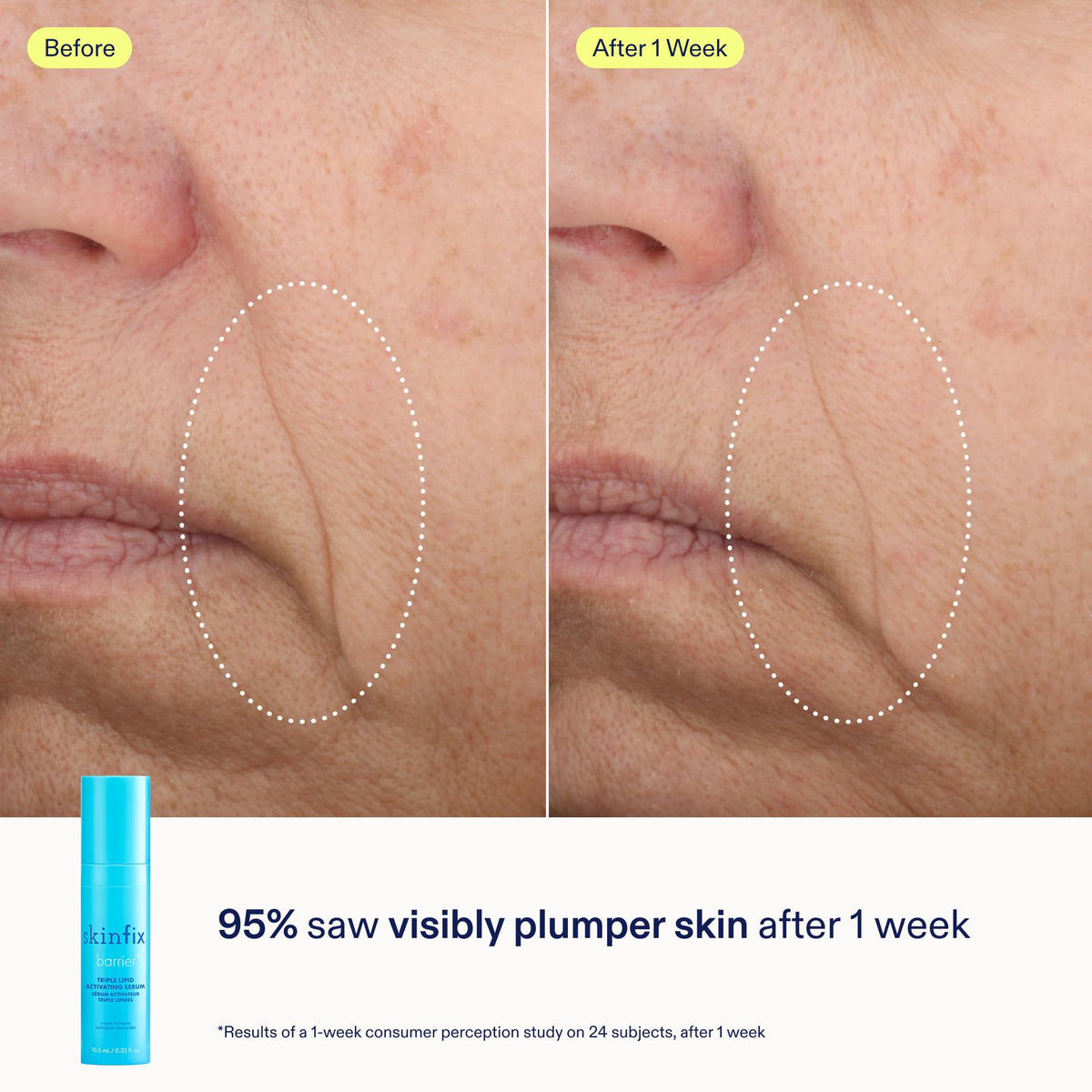 Skinfix mini sizes in hand demonstrating travel-ready convenience
