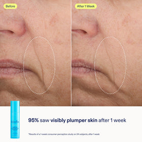 Skinfix mini sizes in hand demonstrating travel-ready convenience