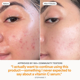 Skinfix pipette applying serum to cheek for targeted brightening benefit