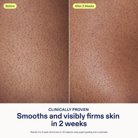 Skinfix pump dispensing cream on fingertip, demonstrates easy application