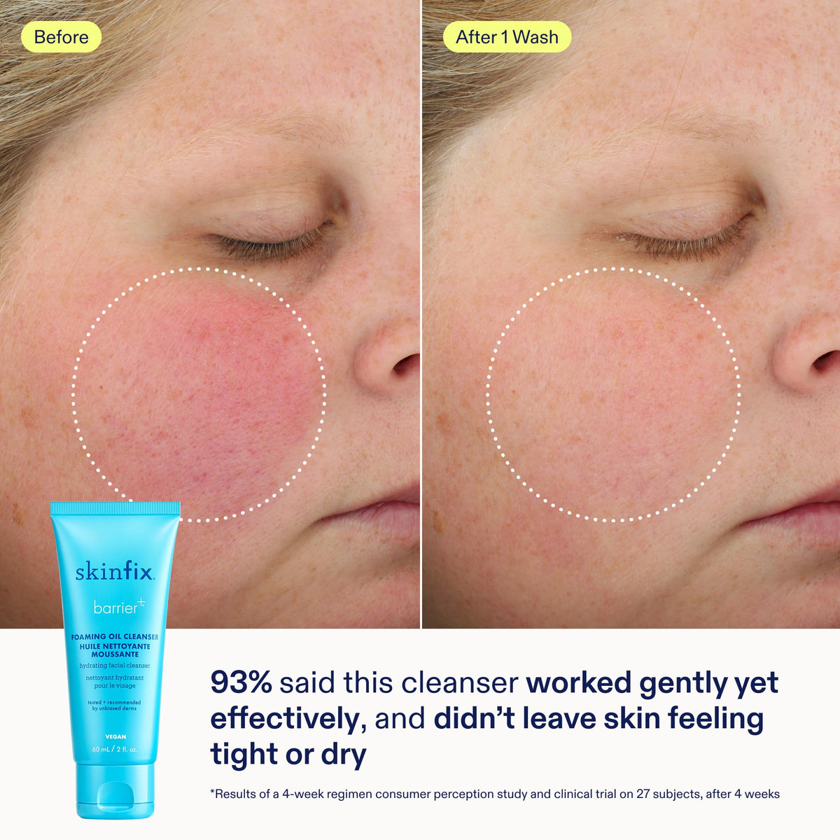 Skinfix serum dropper detail highlighting concentrated plumping benefit