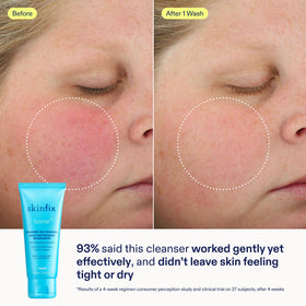 Skinfix serum dropper detail highlighting concentrated plumping benefit