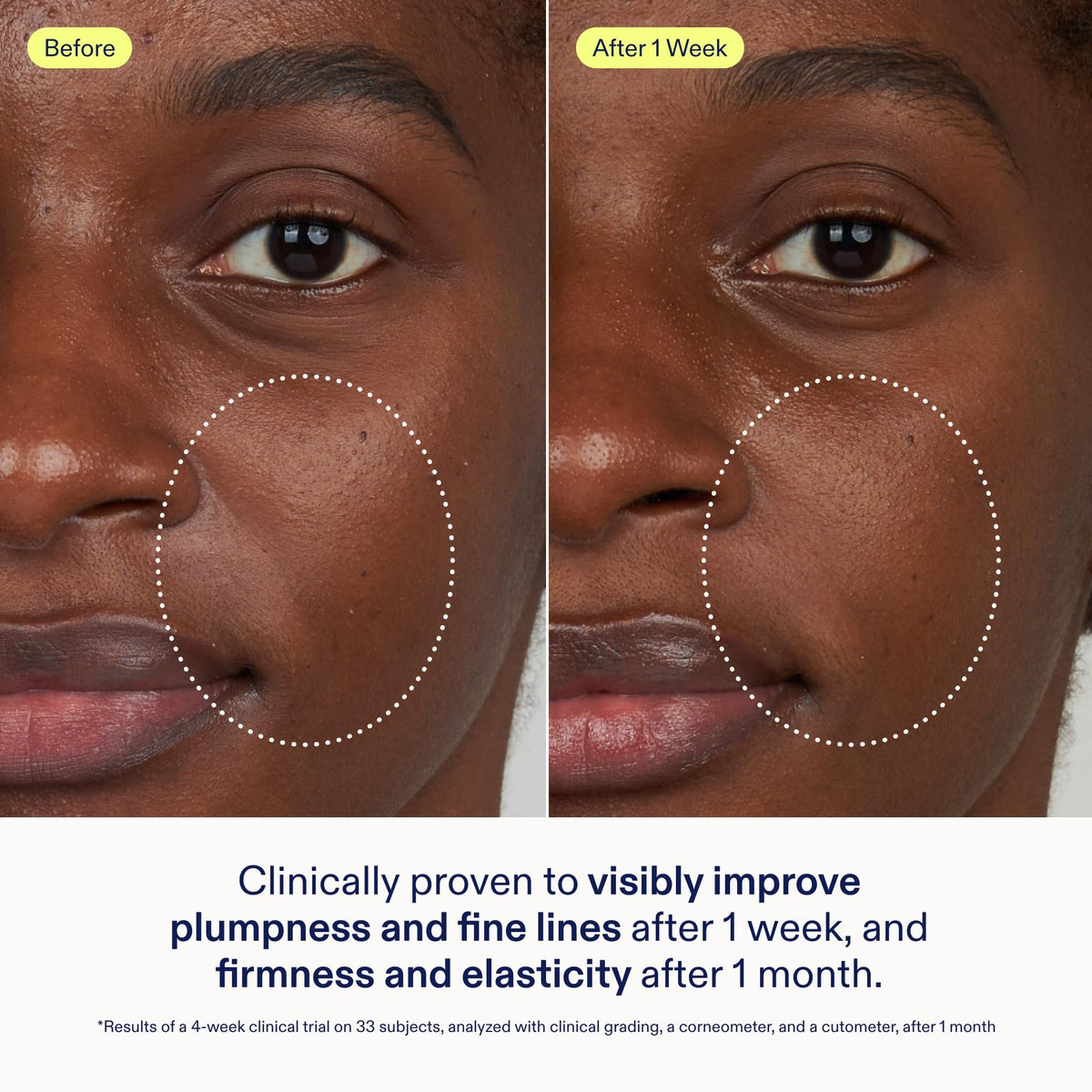 Skinfix serum texture on hand showing cushiony hydration benefit