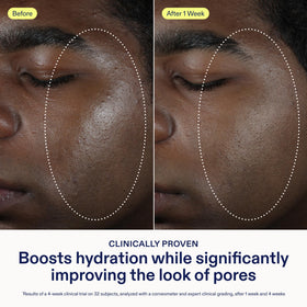 Skinfix product with niacinamide focus label and droplets, emphasizes oil-balancing benefit for skin
