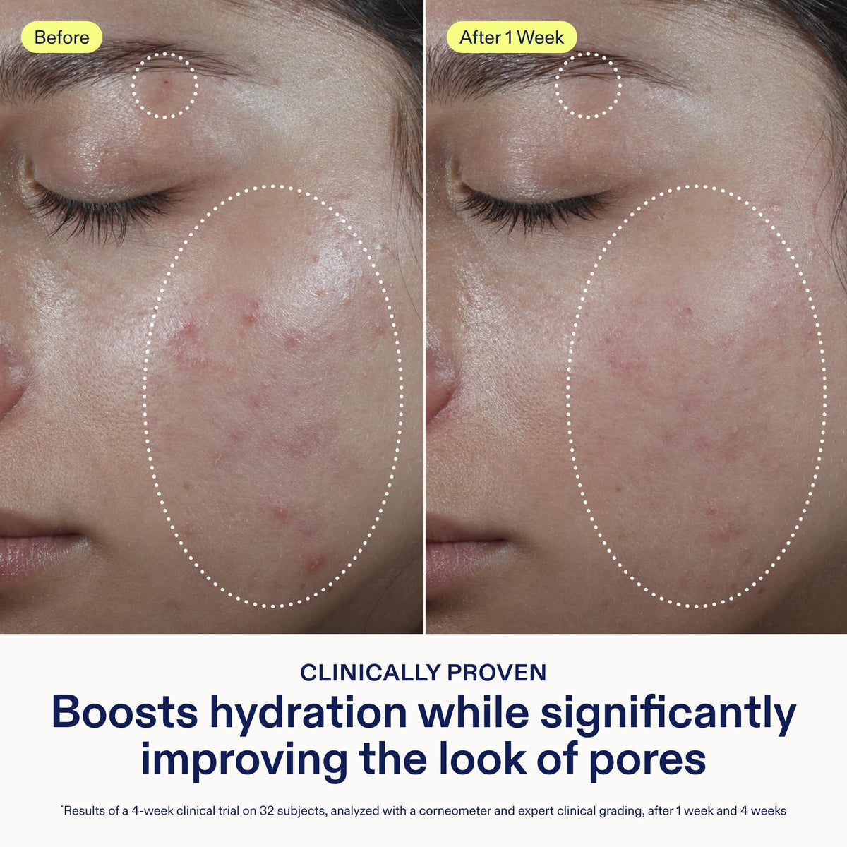 Skinfix pump dispensing cream highlighting easy controlled application