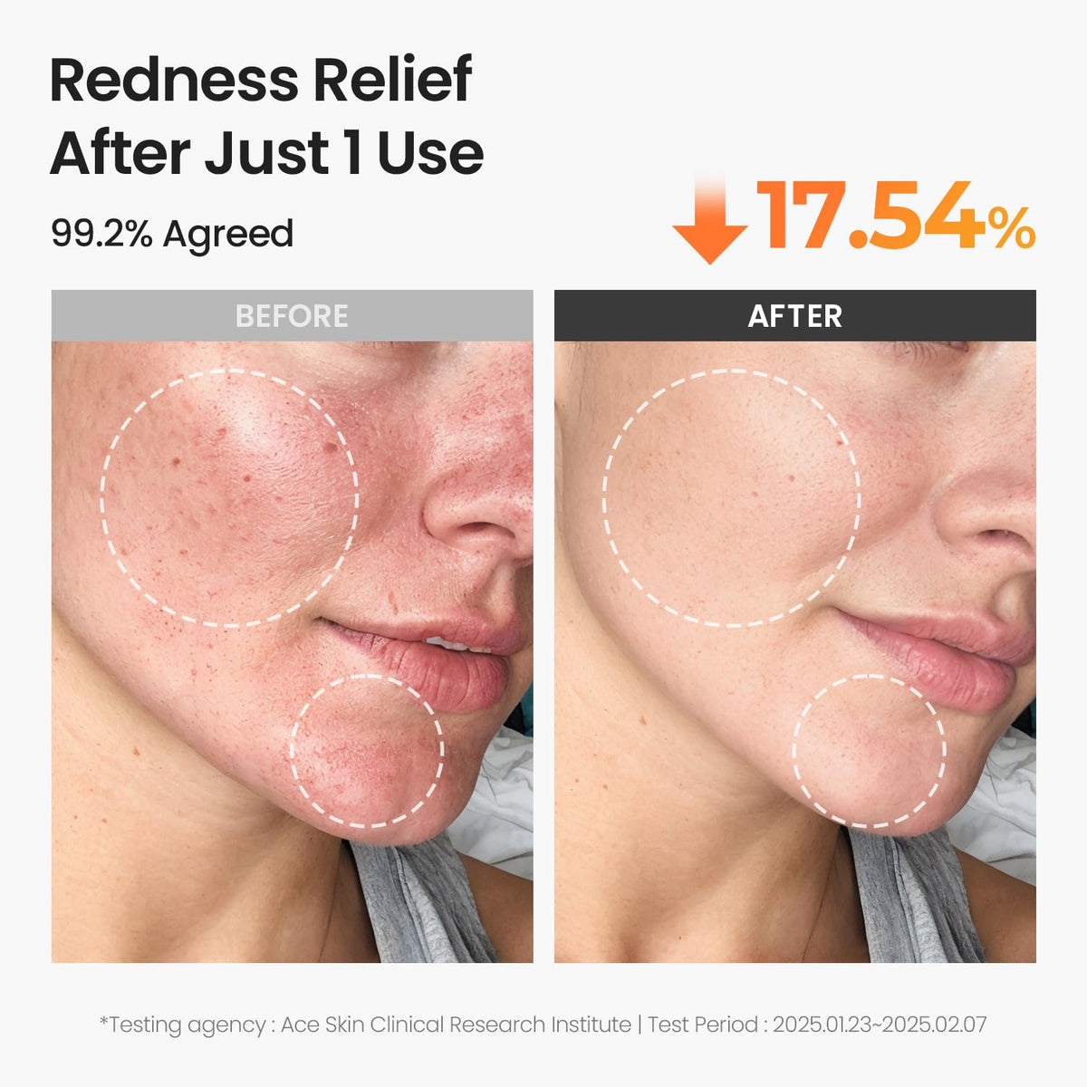 Applying a SKINFOOD carrot carotene toner pad to face to soothe and hydrate skin quickly