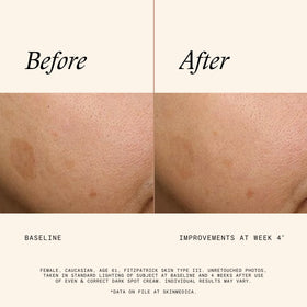 SkinMedica pump dispensing product for accurate dosing benefit