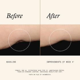 SkinMedica application on upper arms illustrating smoother, firmer-looking skin