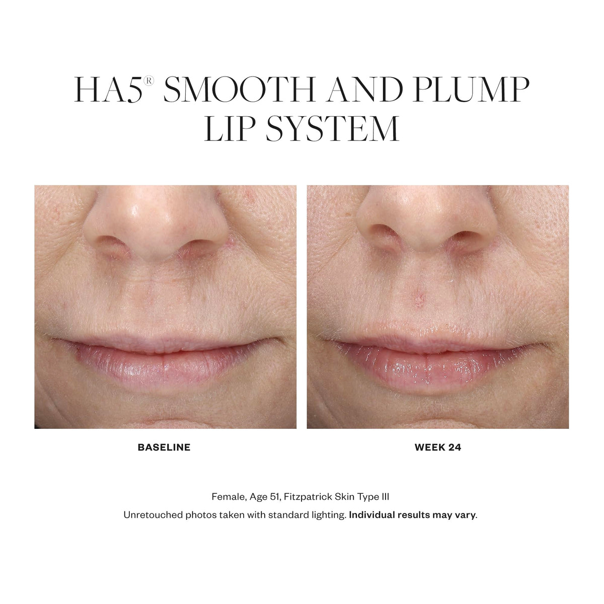 SkinMedica HA5 texture closeup displaying creamy finish for immediate smoothing effect